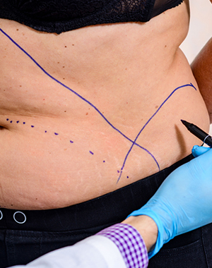Cosmetic Surgery Image