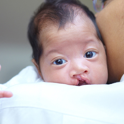Pediatric plastic surgery