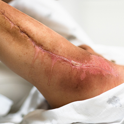 Reconstructive surgeon in Guntur